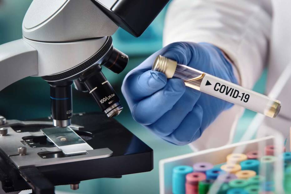Covid-19 Probe im Labor